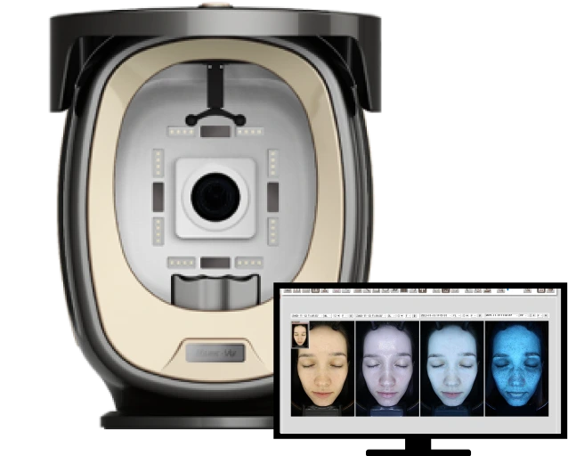 PSI Plus Mark-Vu skin imaging system and analysis monitor