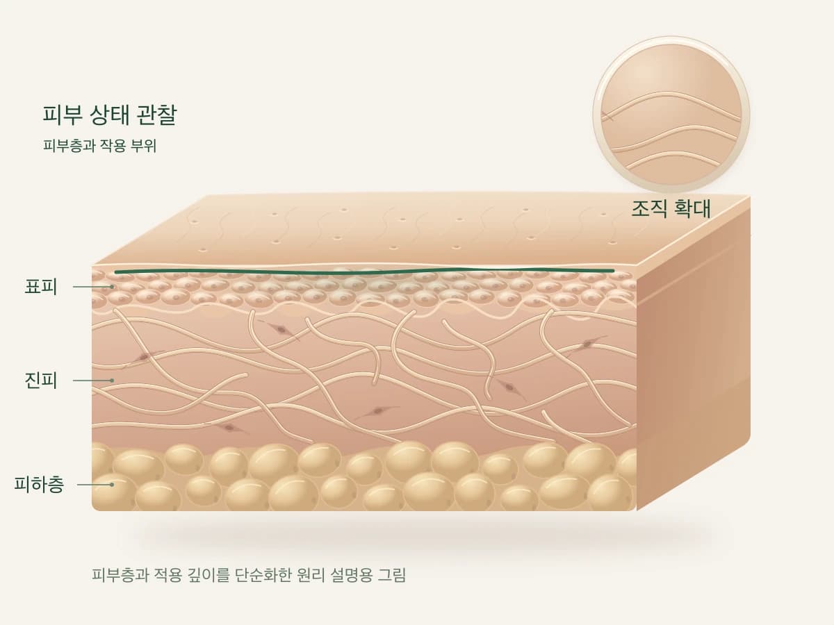 피부 상태를 살피는 과정을 그린 피부 단면