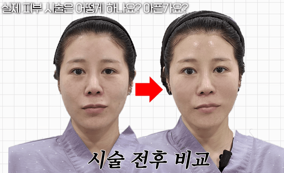 쥬브아셀 후기
